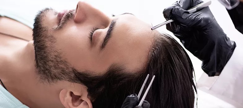 Top Hair Transplant London Surgeons You Can Trust