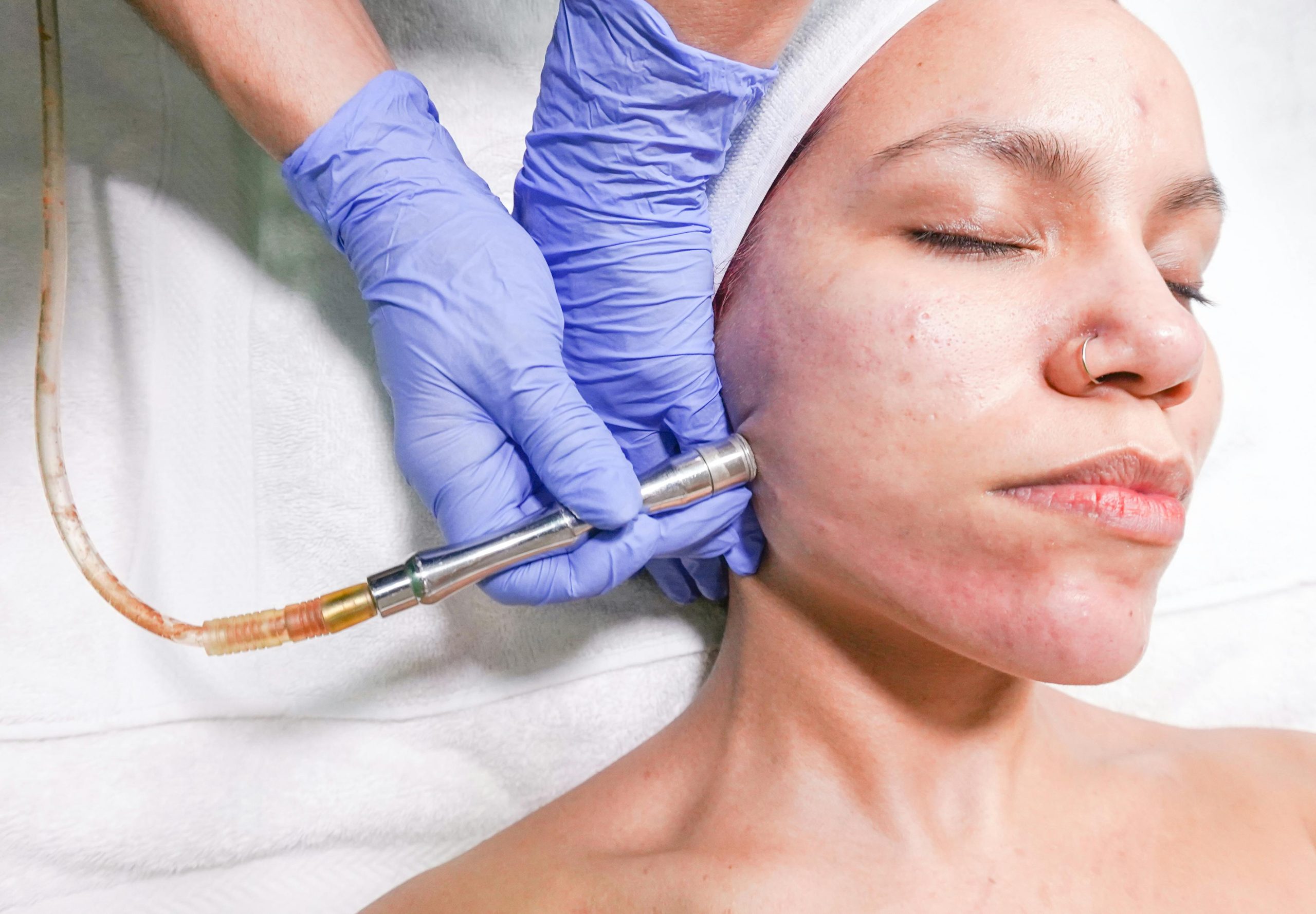 Advanced Face Treatments at Vim Wellness FNP for Radiant Skin